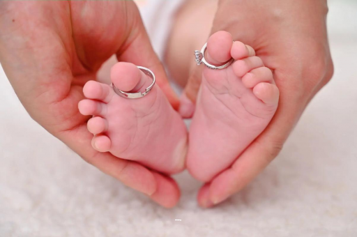 新余孕妇怎样预防妊娠纹